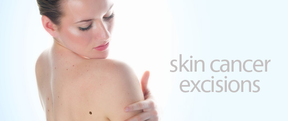 skin cancer excisions